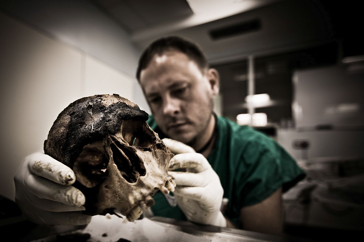 A United Nations forensic pathologist, examines the remains of an unknown girl, about 8-10 years  old, found in a mass grave