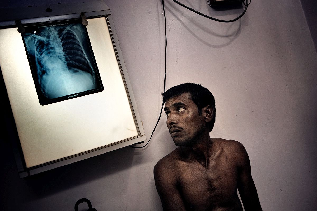 In Dhanbad medical clinic a miner looks at his chest x-ray picture, seeing the devastating effects of pollution which left him with only one compromised lung.