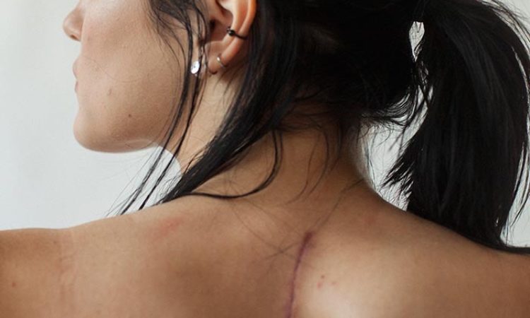 Sophie Mayanne: Scars